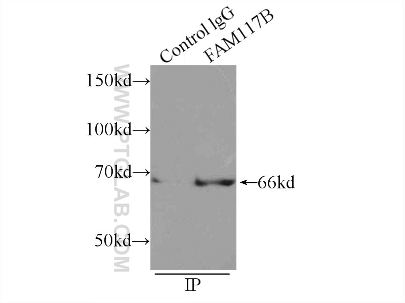 Immunoprecipitation (IP) experiment of HEK-293 cells using FAM117B Polyclonal antibody (21768-1-AP)