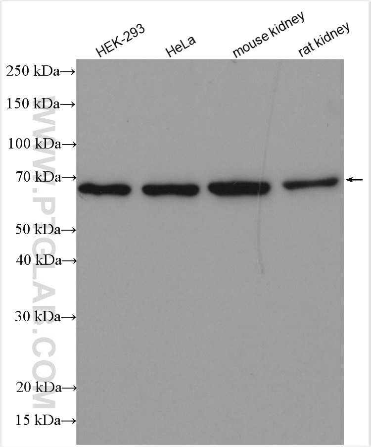 Western Blot (WB) analysis of various lysates using FAM117B Polyclonal antibody (21768-1-AP)