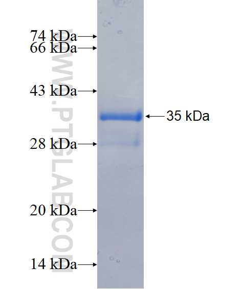 FAM117B fusion protein Ag16407 SDS-PAGE
