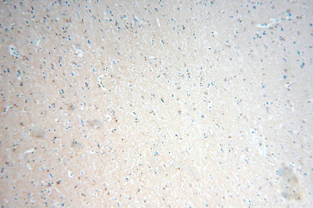 Immunohistochemistry (IHC) staining of human brain tissue using FAM118B Polyclonal antibody (18159-1-AP)