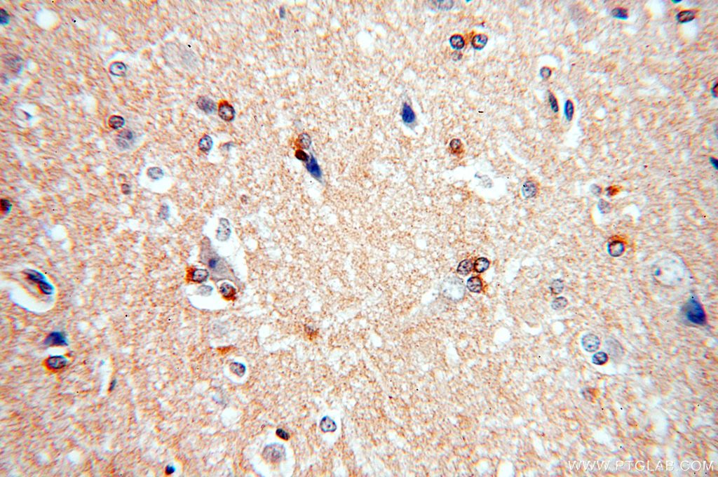 Immunohistochemistry (IHC) staining of human brain tissue using FAM118B Polyclonal antibody (18159-1-AP)