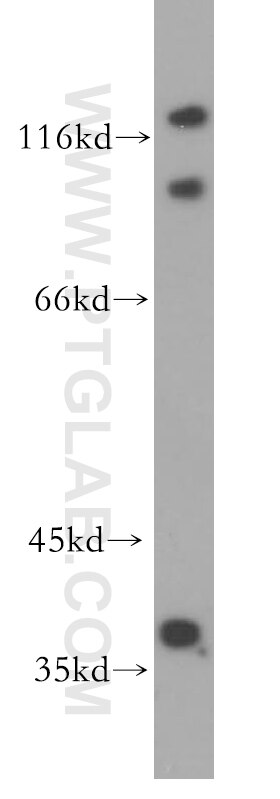 Western Blot (WB) analysis of human brain tissue using FAM118B Polyclonal antibody (18159-1-AP)