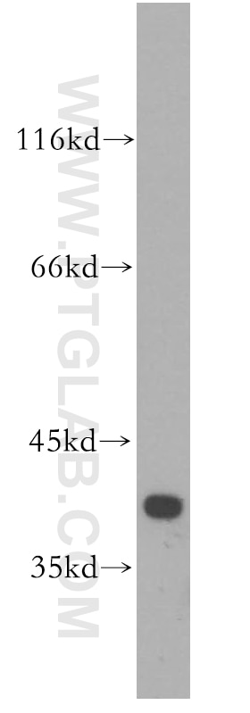 WB analysis of HeLa using 18159-1-AP