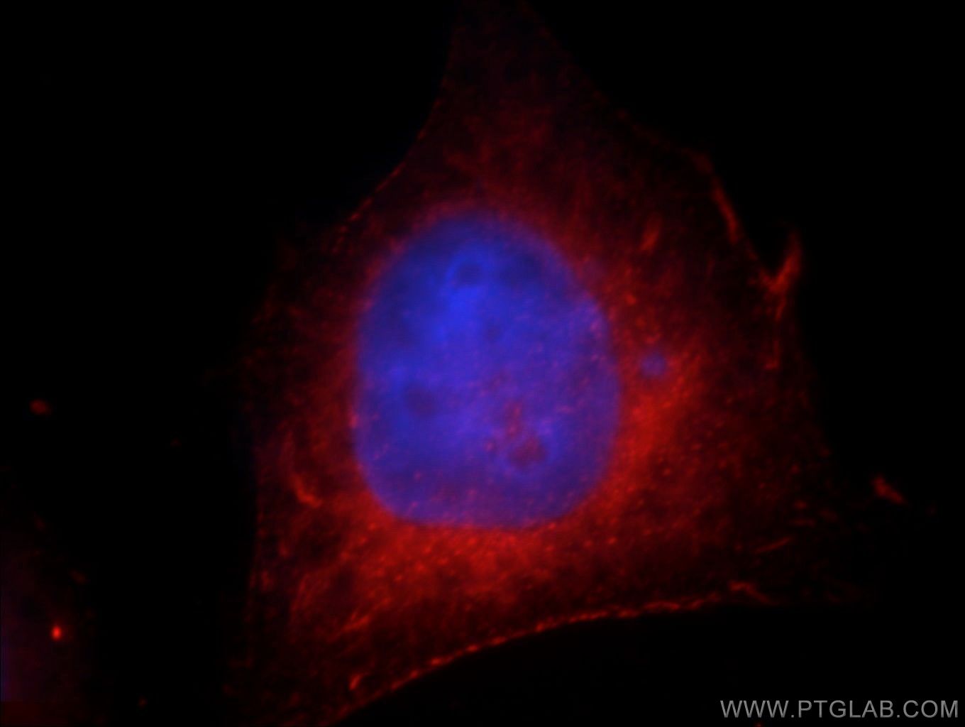 Immunofluorescence (IF) / fluorescent staining of HeLa cells using FAM119A Polyclonal antibody (21079-1-AP)