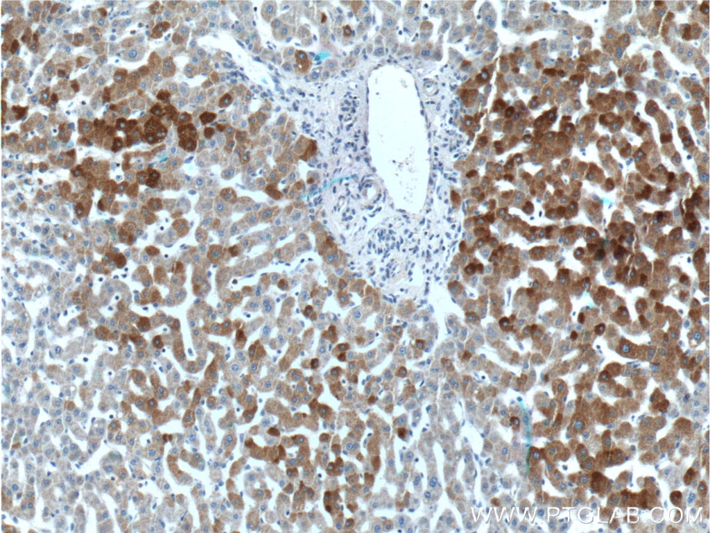 Immunohistochemistry (IHC) staining of human liver tissue using FAM119A Polyclonal antibody (21079-1-AP)