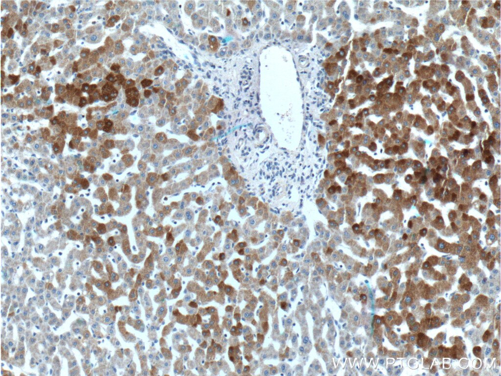 Immunohistochemistry (IHC) staining of human liver tissue using FAM119A Polyclonal antibody (21079-1-AP)