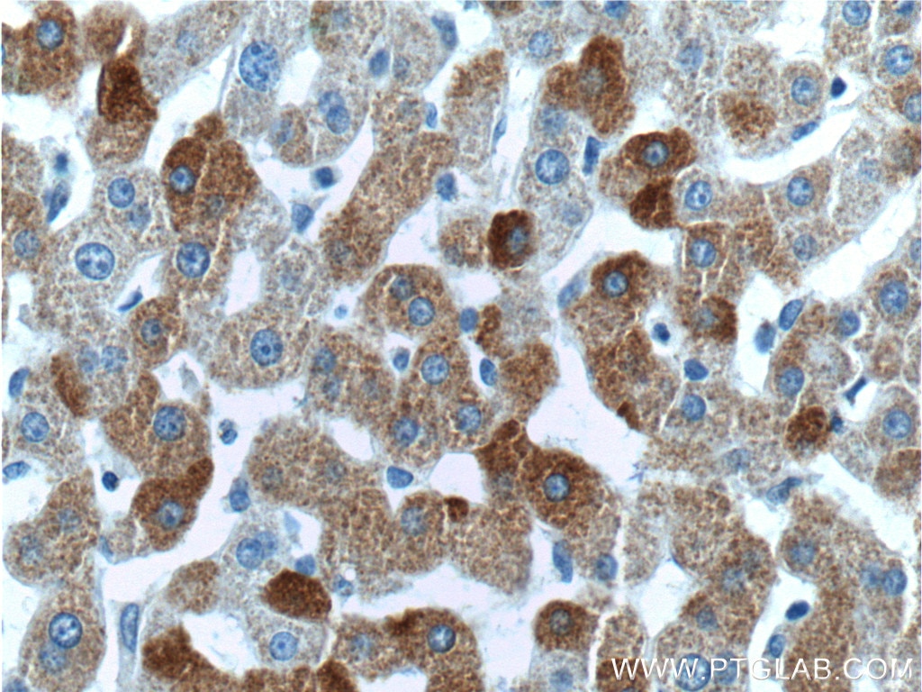 Immunohistochemistry (IHC) staining of human liver tissue using FAM119A Polyclonal antibody (21079-1-AP)