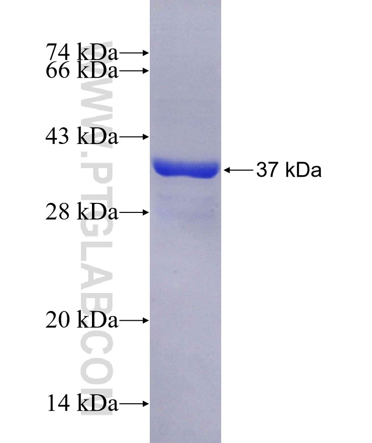 FAM119A fusion protein Ag15282 SDS-PAGE