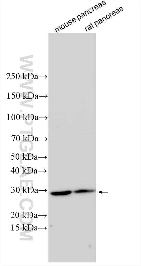 WB analysis using 33982-1-AP (same clone as 33982-1-PBS) Western Blot (WB) analysis of various lysates using FAM119B Polyclonal antibody (33982-1-AP)