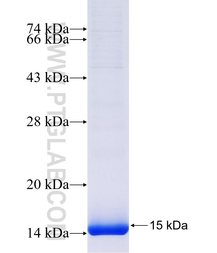 FAM119B fusion protein Ag40816 SDS-PAGE