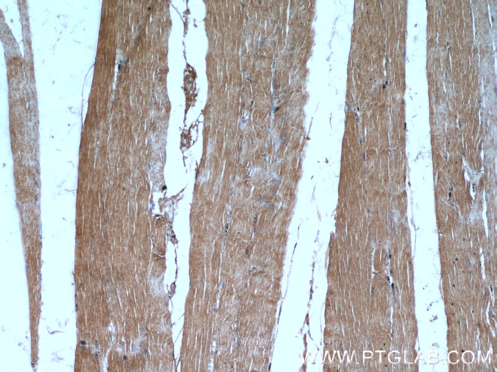 Immunohistochemistry (IHC) staining of human skeletal muscle tissue using FAM120A Polyclonal antibody (21529-1-AP)