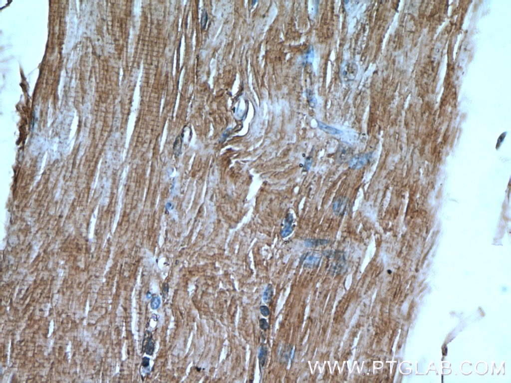 Immunohistochemistry (IHC) staining of human skeletal muscle tissue using FAM120A Polyclonal antibody (21529-1-AP)