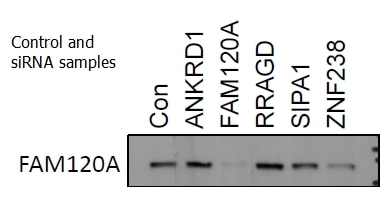 Western Blot (WB) analysis of siRNA cells using FAM120A Polyclonal antibody (21529-1-AP)