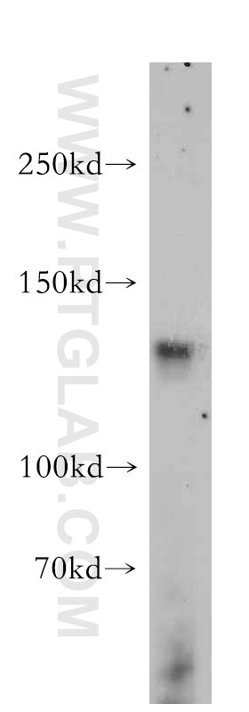 Western Blot (WB) analysis of HepG2 cells using FAM120A Polyclonal antibody (21529-1-AP)