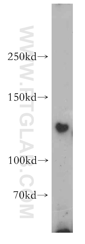 Western Blot (WB) analysis of HEK-293 cells using FAM120A Polyclonal antibody (21529-1-AP)