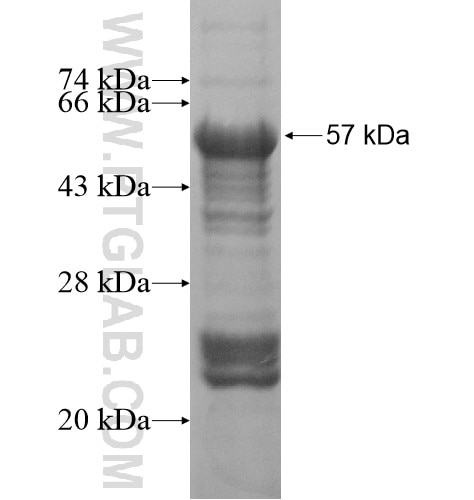 FAM120A fusion protein Ag16149 SDS-PAGE