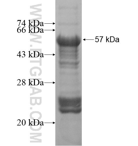 FAM120A fusion protein Ag16149 SDS-PAGE