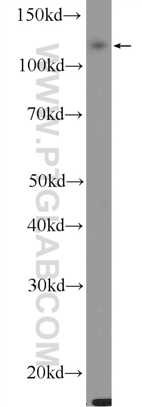 Western Blot (WB) analysis of HepG2 cells using FAM120C Polyclonal antibody (25987-1-AP)