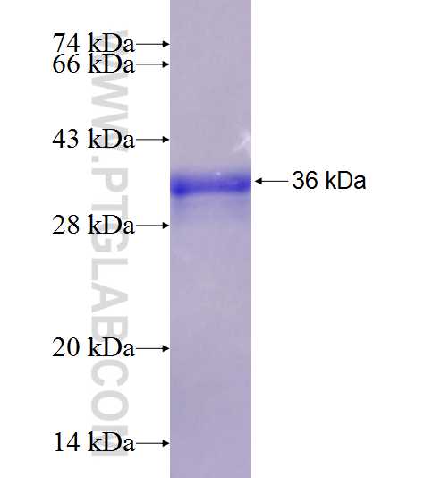 FAM122A fusion protein Ag18992 SDS-PAGE