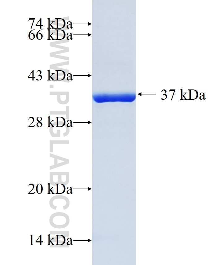 FAM122A fusion protein Ag18992 SDS-PAGE