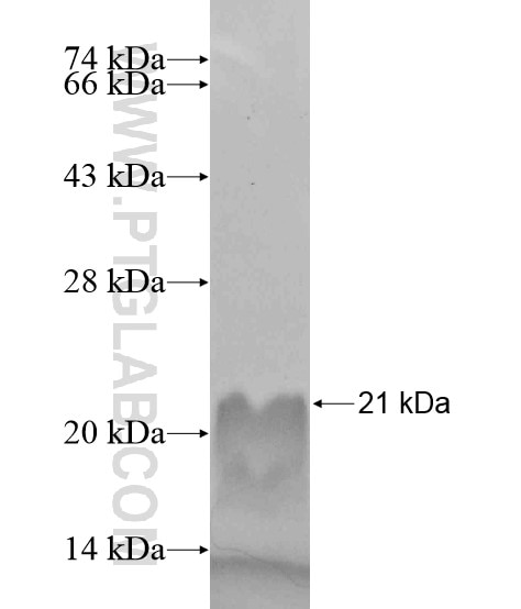 FAM122A fusion protein Ag19118 SDS-PAGE