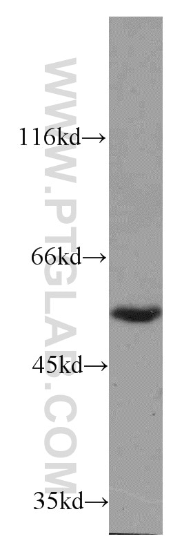 Western Blot (WB) analysis of K-562 cells using FAM124B Polyclonal antibody (21313-1-AP)