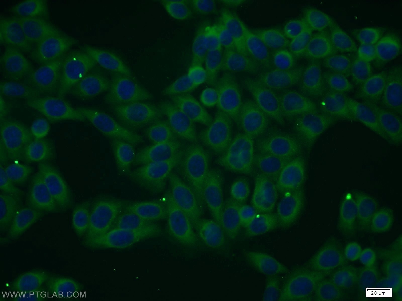 Immunofluorescence (IF) / fluorescent staining of HeLa cells using FAM125A Polyclonal antibody (25816-1-AP)