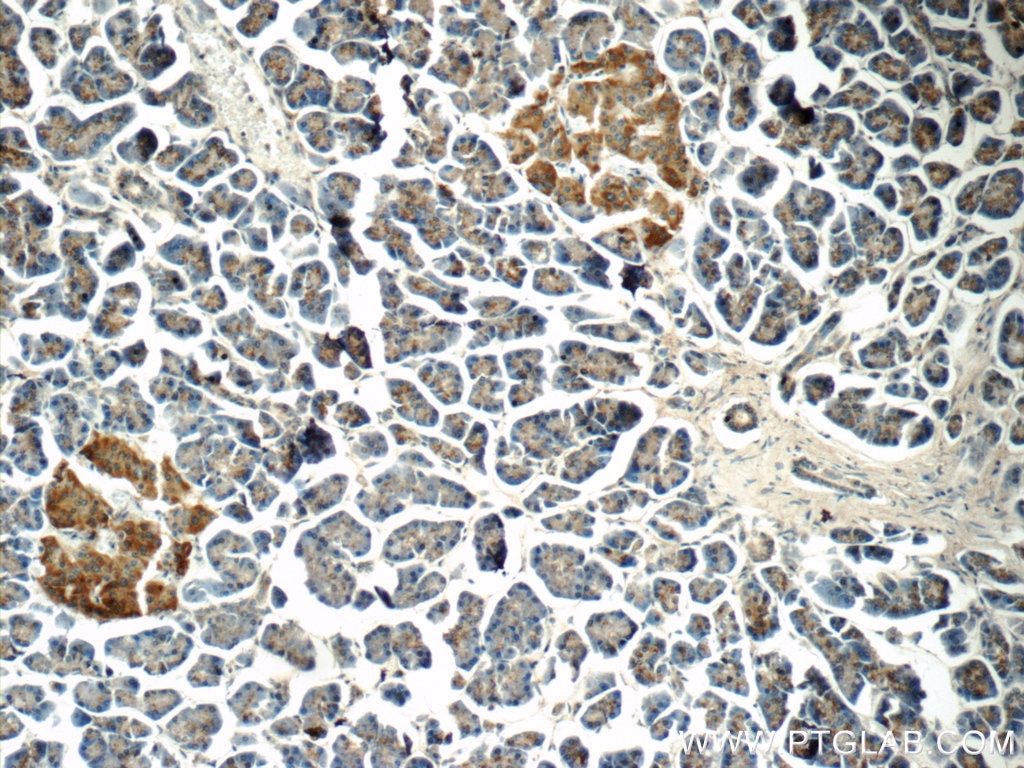 Immunohistochemistry (IHC) staining of human pancreas tissue using FAM125A Polyclonal antibody (25816-1-AP)