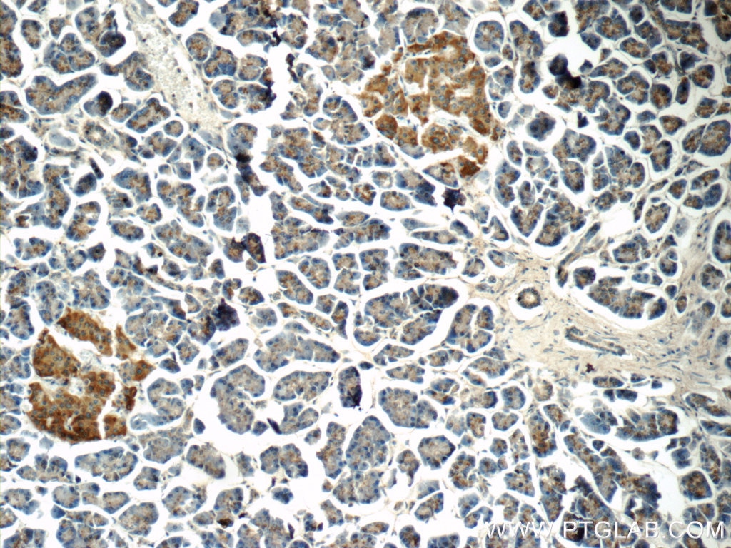 IHC staining of human pancreas using 25816-1-AP