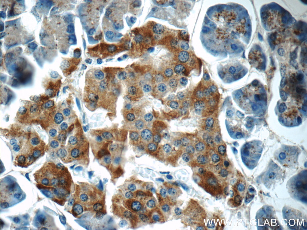 Immunohistochemistry (IHC) staining of human pancreas tissue using FAM125A Polyclonal antibody (25816-1-AP)