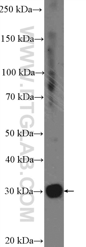 Western Blot (WB) analysis of Jurkat cells using FAM125A Polyclonal antibody (25816-1-AP)