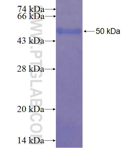 FAM125A fusion protein Ag22919 SDS-PAGE