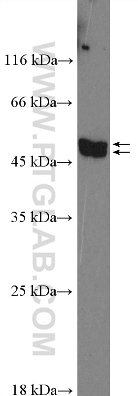 Western Blot (WB) analysis of A431 cells using FAM126A Polyclonal antibody (26243-1-AP)