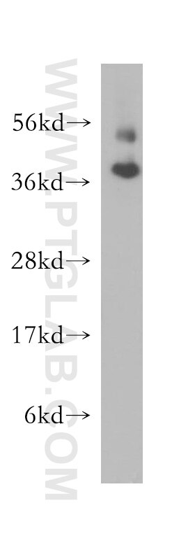 Western Blot (WB) analysis of human brain tissue using FAM127A Polyclonal antibody (10307-1-AP)