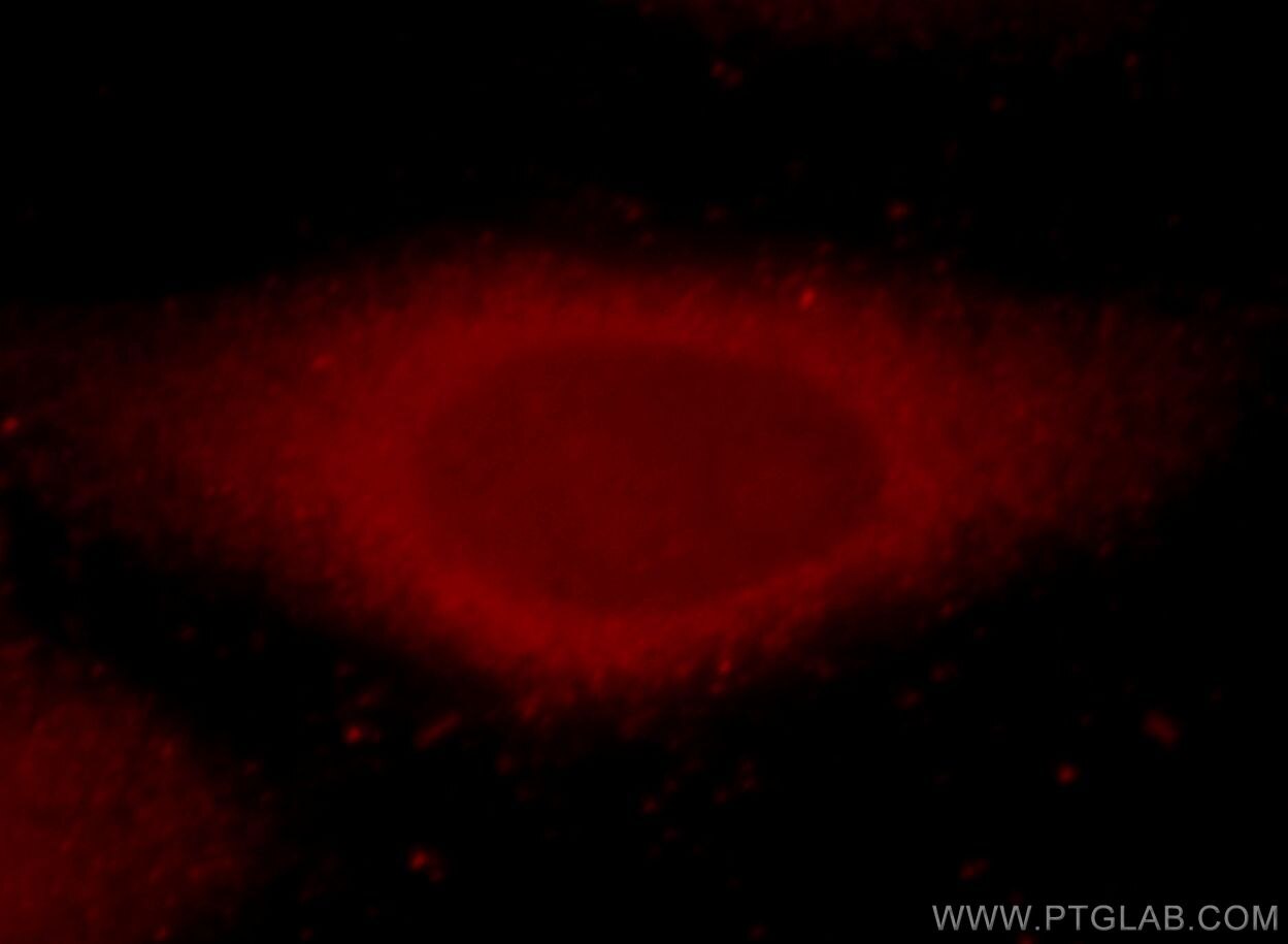 Immunofluorescence (IF) / fluorescent staining of HepG2 cells using FAM127B Polyclonal antibody (20282-1-AP)