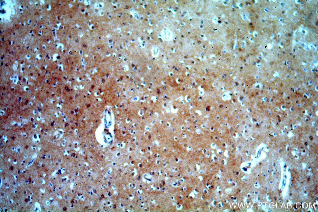 Immunohistochemistry (IHC) staining of human brain tissue using FAM127B Polyclonal antibody (20282-1-AP)