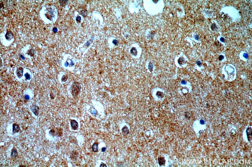 Immunohistochemistry (IHC) staining of human brain tissue using FAM127B Polyclonal antibody (20282-1-AP)