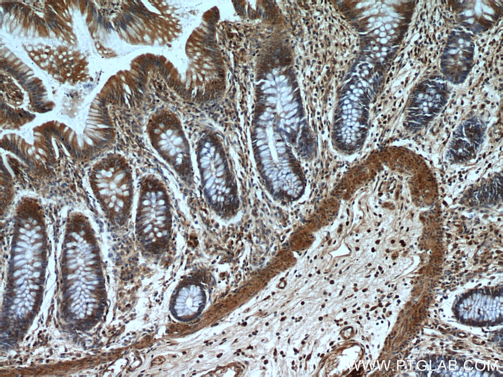 Immunohistochemistry (IHC) staining of human colon tissue using FAM127B Polyclonal antibody (20282-1-AP)