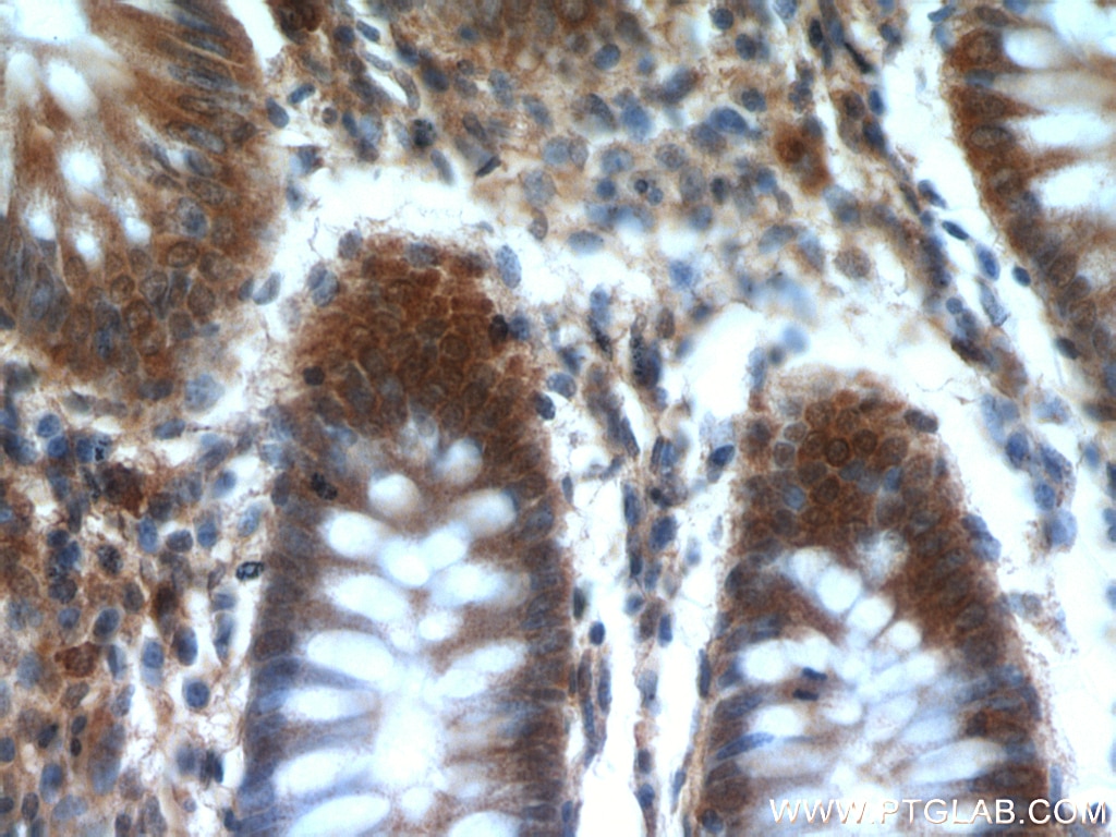 IHC staining of human colon using 20282-1-AP