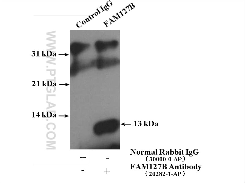 Immunoprecipitation (IP) experiment of PC-3 cells using FAM127B Polyclonal antibody (20282-1-AP)