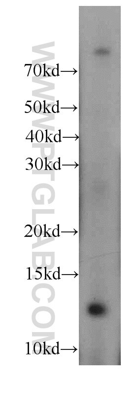 WB analysis of HeLa using 20282-1-AP