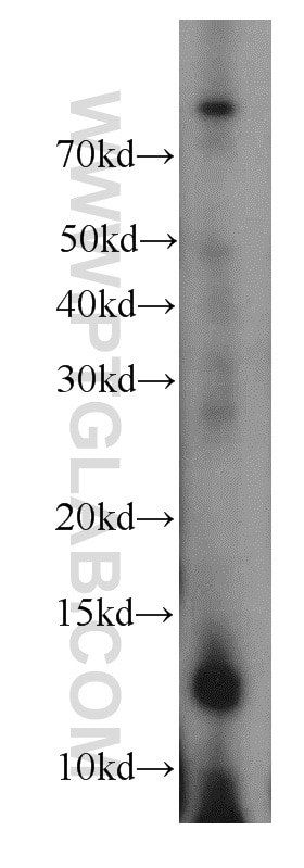 Western Blot (WB) analysis of PC-3 cells using FAM127B Polyclonal antibody (20282-1-AP)