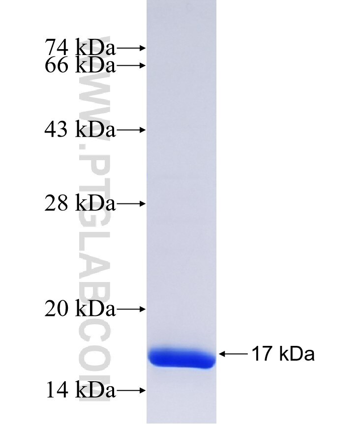 FAM127B fusion protein Ag37520 SDS-PAGE FAM127B fusion protein Ag37520 SDS-PAGE