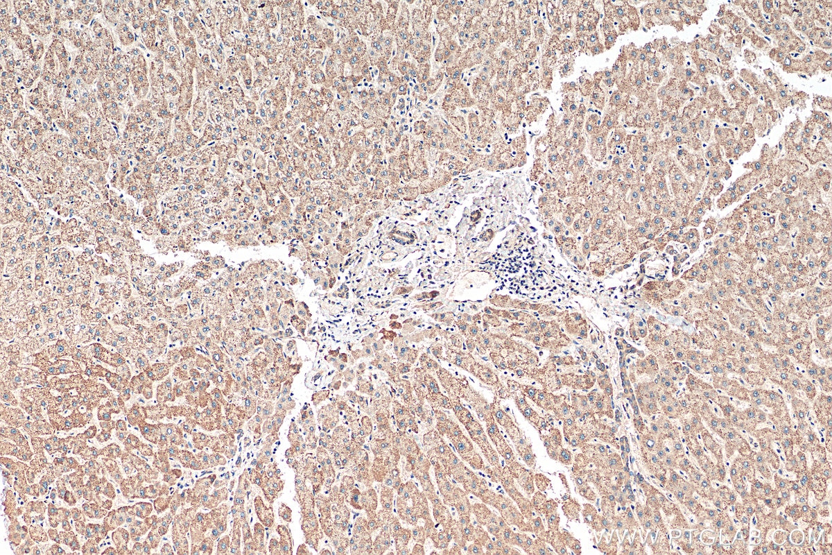 IHC staining of human liver using 22553-1-AP