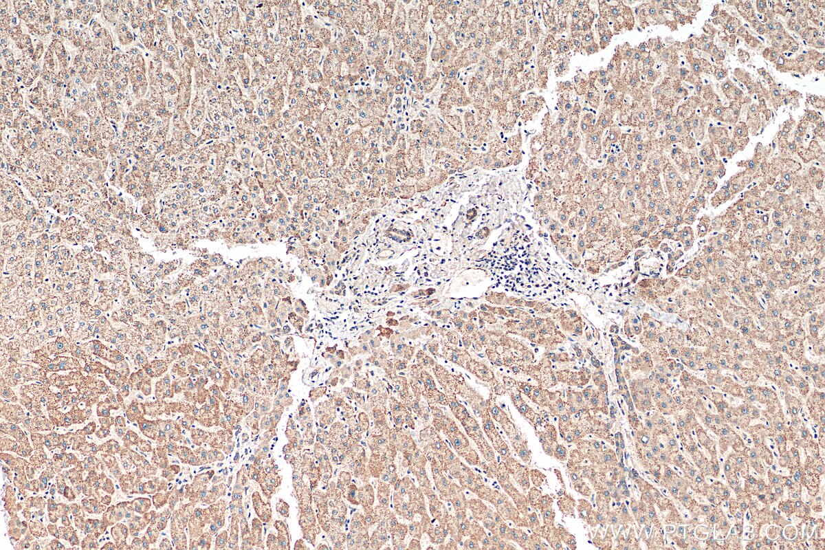 Immunohistochemistry (IHC) staining of human liver tissue using FAM129B Polyclonal antibody (22553-1-AP)