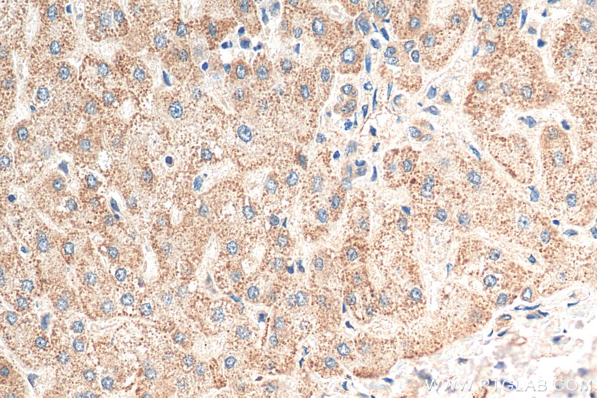 Immunohistochemistry (IHC) staining of human liver tissue using FAM129B Polyclonal antibody (22553-1-AP)