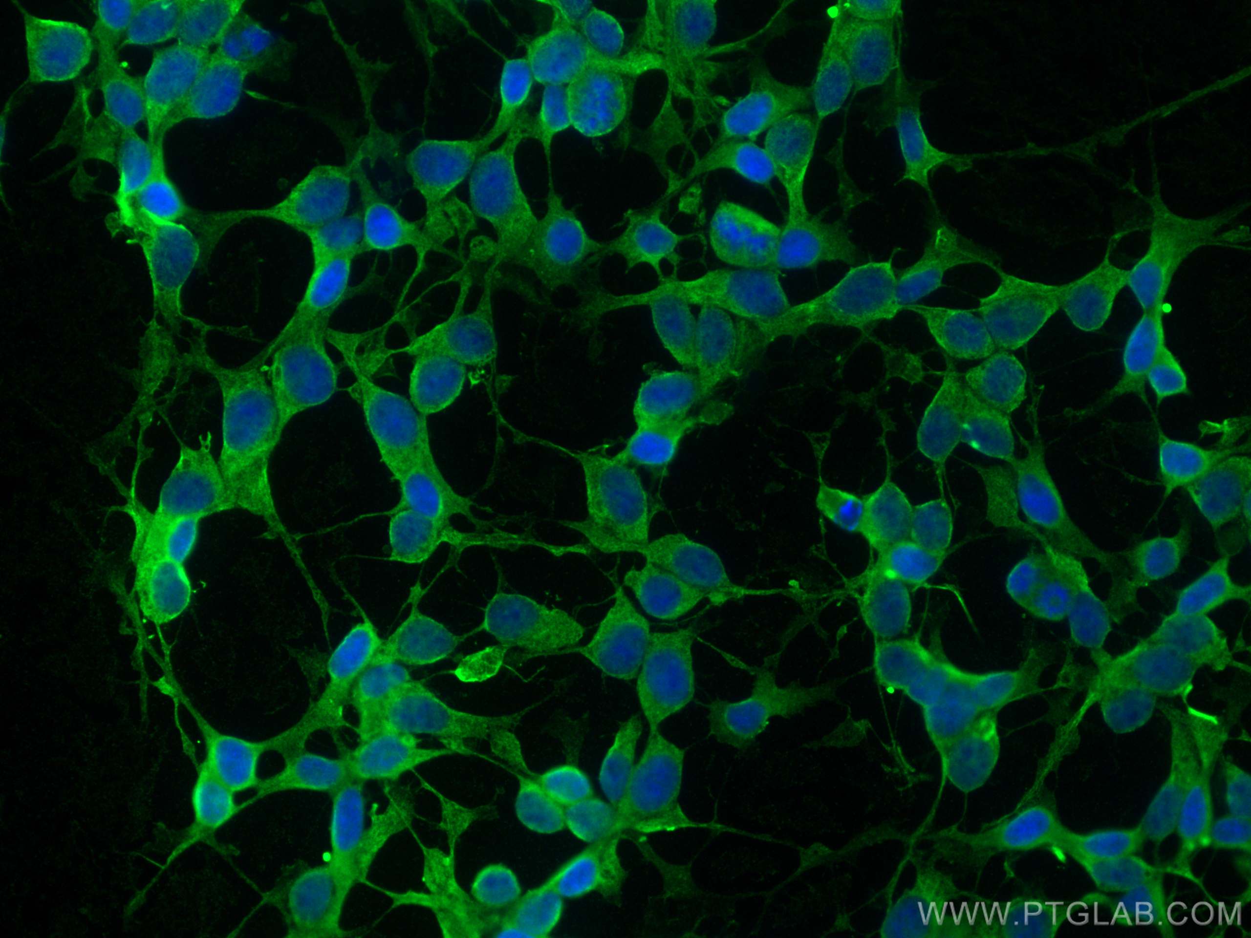 Immunofluorescence (IF) / fluorescent staining of SH-SY5Y cells using FAM131B Polyclonal antibody (26498-1-AP)