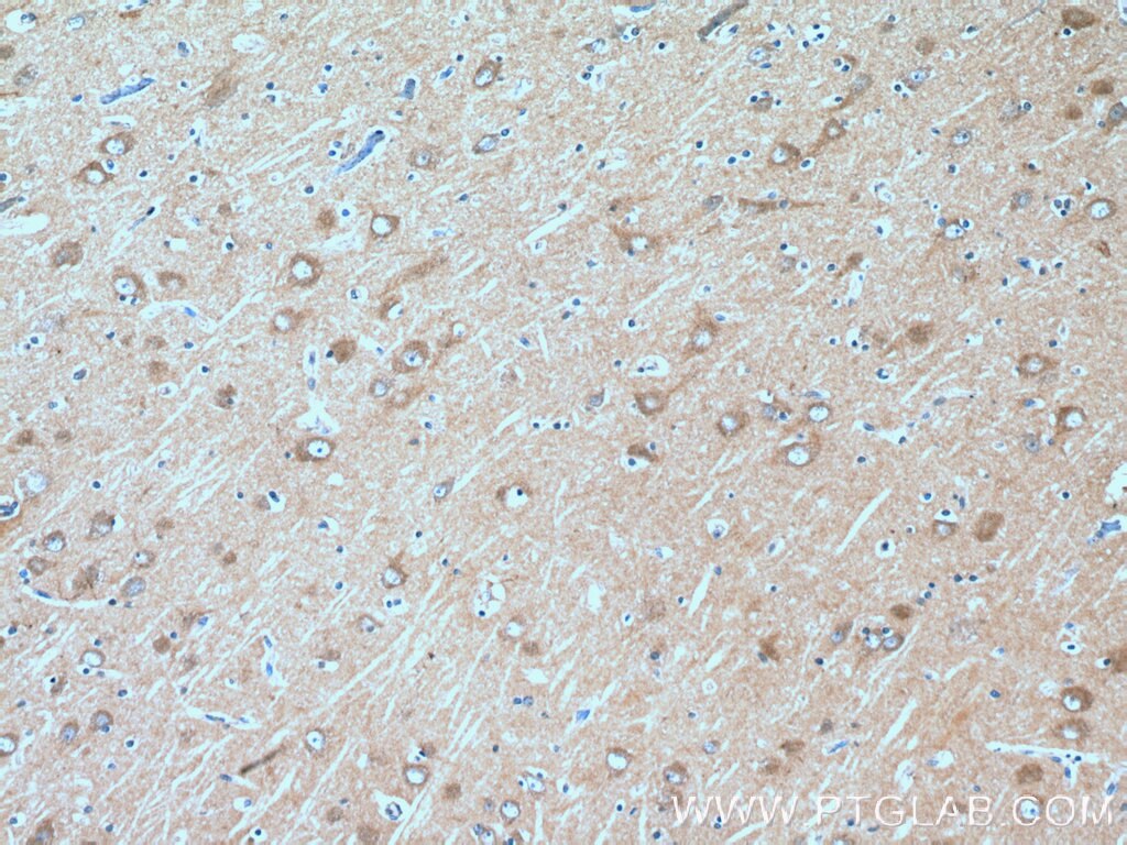 Immunohistochemistry (IHC) staining of human brain tissue using FAM131B Polyclonal antibody (26498-1-AP)