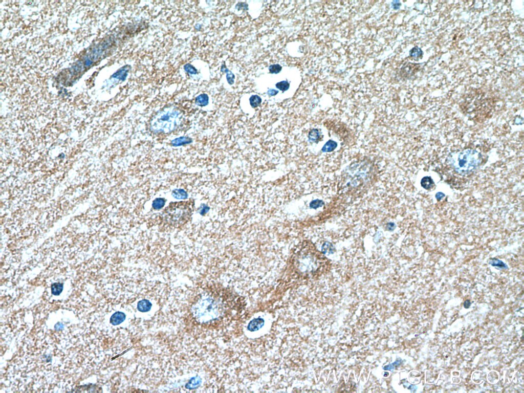 IHC staining of human brain using 26498-1-AP