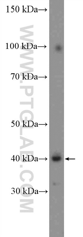 WB analysis of SH-SY5Y using 26498-1-AP